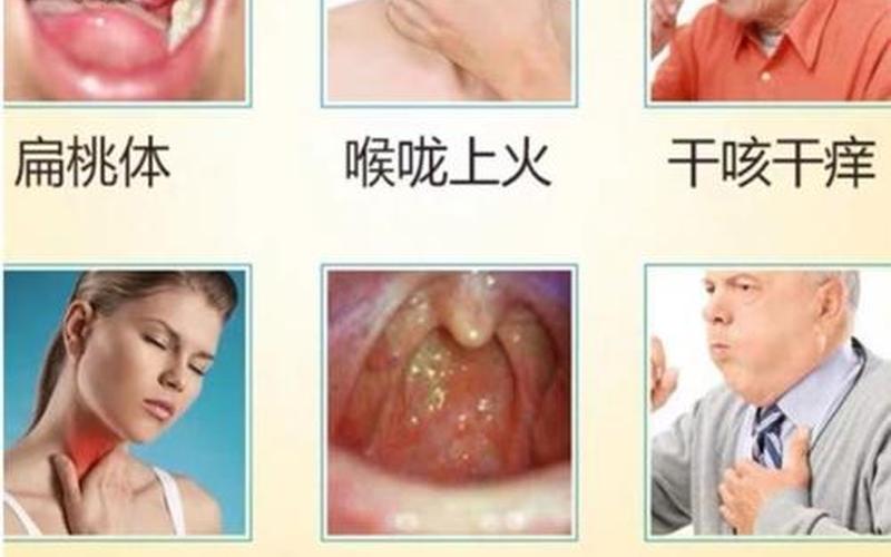 喉咙痒是寒咳还是热咳(夜晚睡觉咳嗽是热咳还是寒咳)