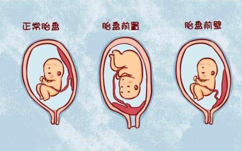 怀男孩是在前壁还是后壁(怀前壁好还是后壁好)