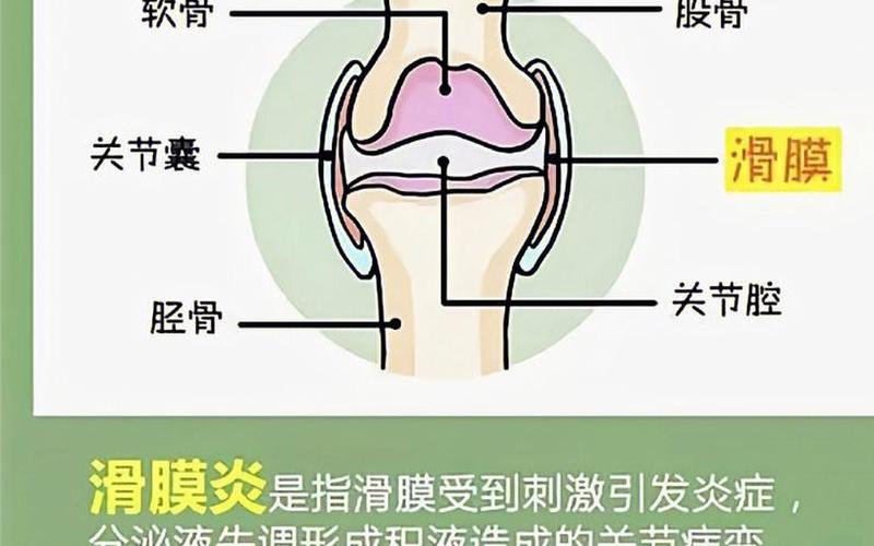 滑膜炎是热敷还是冷敷(滑膜炎一般几天能好)