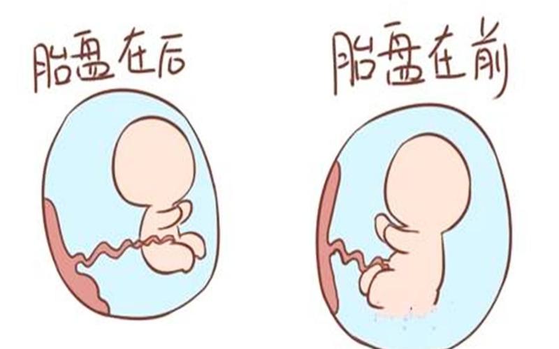 怀女孩是前壁还是后壁(胎儿怀在前壁大多是男孩女孩)