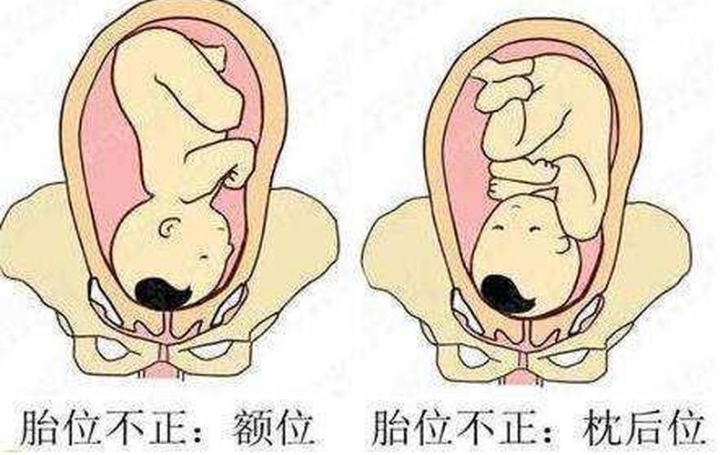 怀的下是男孩还是女孩(胎位下腹部是男是女)