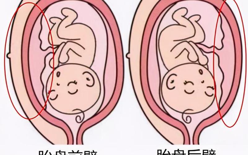 怀孕在子宫前壁是男孩还是女孩(怀孕前壁和后壁的区别)