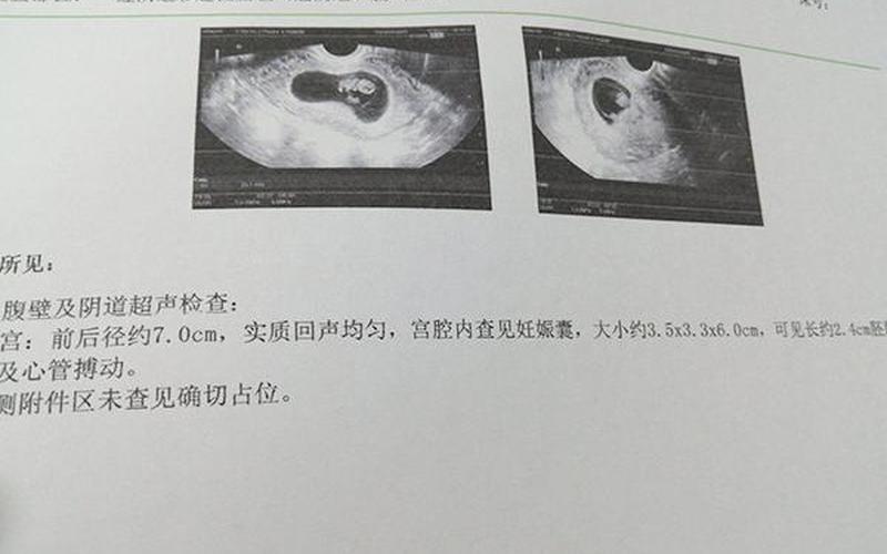 怀孕35天是男孩还是女孩(怀孕生男孩的18个症状)