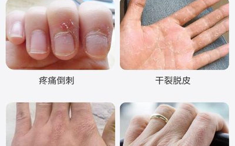 护手霜是酸性还是碱性(漱口水是酸性还是碱性)