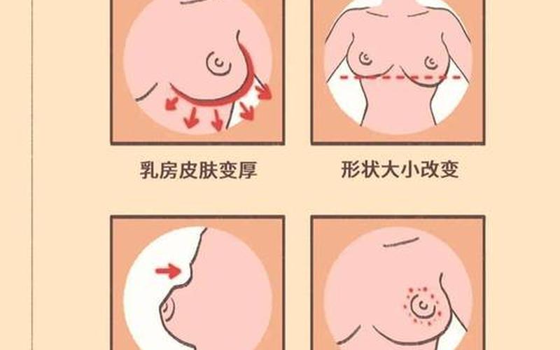 怀孕乳头是硬的还是软(孕初期乳房一个硬一个软)
